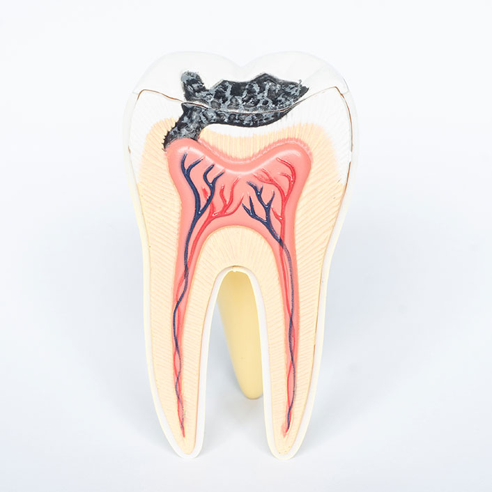 cavity-detection