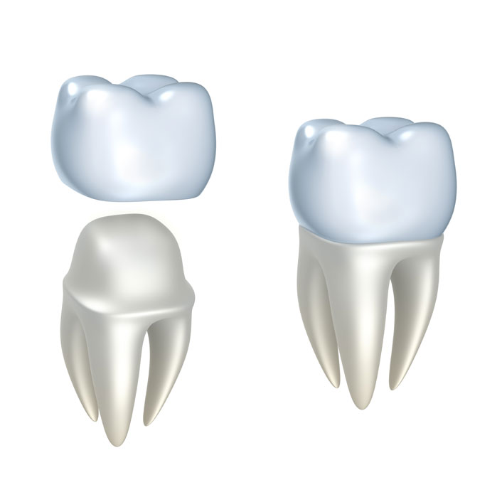 crowns