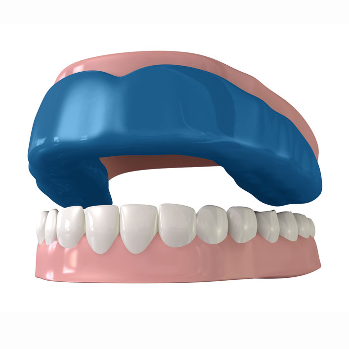 mouth-guard