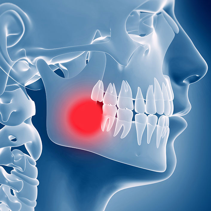 tmj-treatment